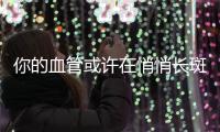 你的血管或许在悄悄长斑�	！这样做	，“斑块”可能缩小→